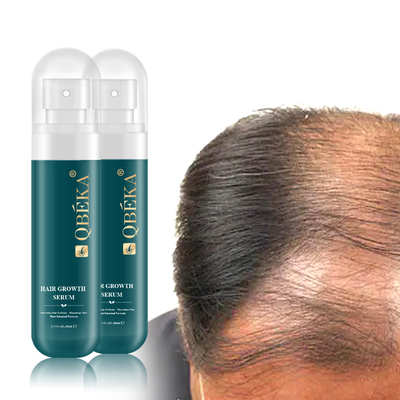 80 ml de suero herbal contra la pérdida de cabello para prevenir la pérdida de cabello