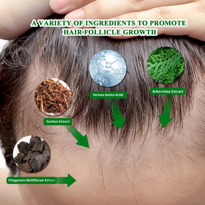 Suero orgánico para el crecimiento del cabello Para uso externo Tratamiento para el crecimiento del cabello contra la pérdida del cabello Spray 80ml 0