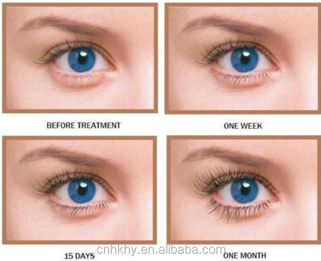 Experimenta pestañas de ojos más largas con Bioenzima Crecimiento de pestañas Suero Vida útil 3 años 1