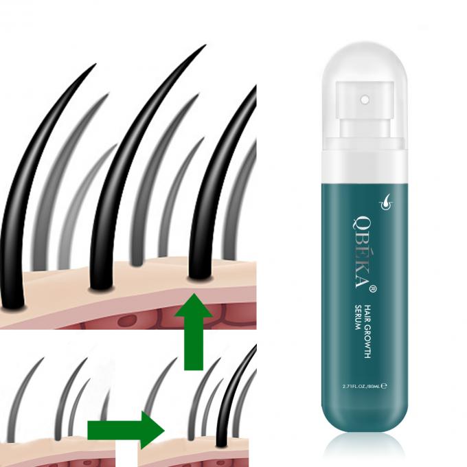80 ml de aceite para el crecimiento del cabello de marca privada producto profesional equipo de control de calidad suero contra la pérdida del cabello 0