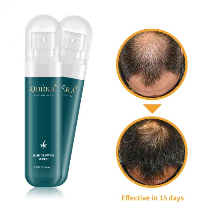 80 ml de aceite para el crecimiento del cabello de marca privada producto profesional equipo de control de calidad suero contra la pérdida del cabello 1