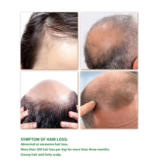 15 Una planta natural rara extrae suero para el crecimiento del cabello para tratamiento privado con mejores resultados 1