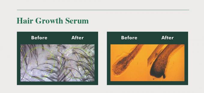 Tónico de hierbas para el cabello para hombres Prevenir la pérdida de cabello Regresar el cabello Mejorar el volumen 3 meses de suministro 2