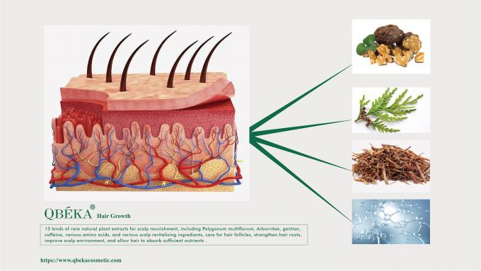 Shampoo estándar de prevención de la pérdida de cabello para el tratamiento de la pérdida y adelgazamiento del cabello 80m 3
