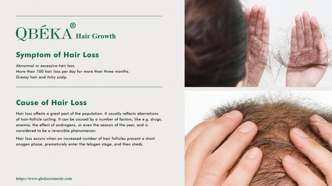 Shampoo estándar de prevención de la pérdida de cabello para el tratamiento de la pérdida y adelgazamiento del cabello 80m 0