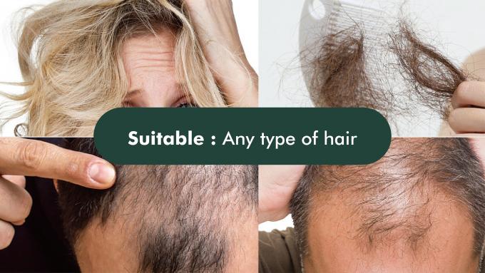 Shampoo estándar de prevención de la pérdida de cabello para el tratamiento de la pérdida y adelgazamiento del cabello 80m 12