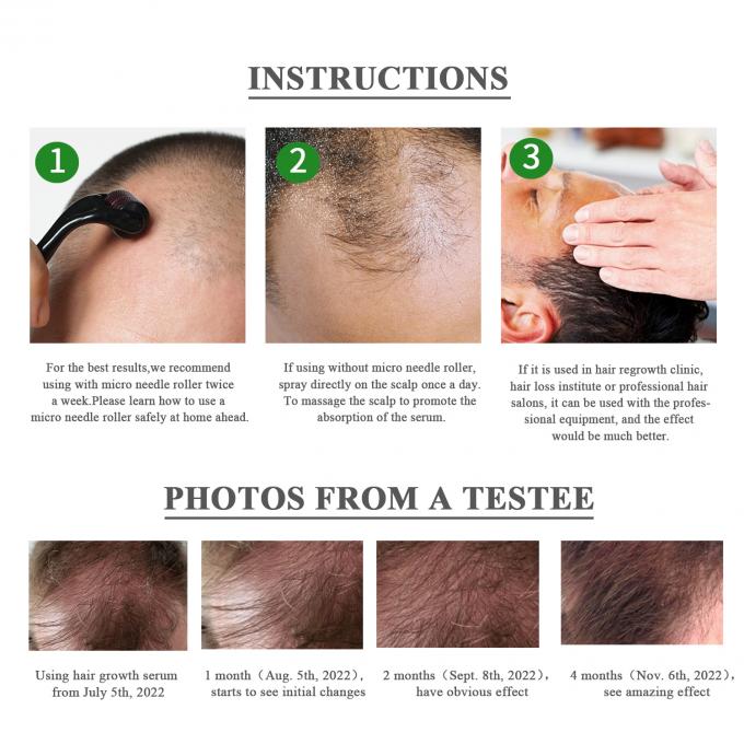 Hierbas 7-15 días suero para el crecimiento del cabello restaurar el volumen y brillo de su cabello sin esfuerzo 3