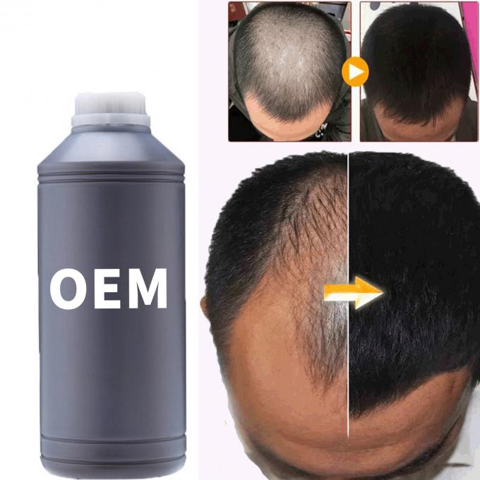 36 meses Vida útil El aceite de suero para el crecimiento del cabello para todos los tipos de cabello 3