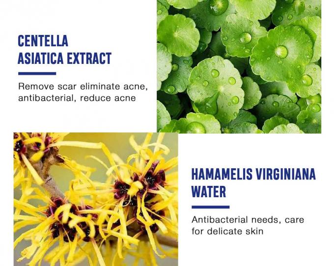 Cremas naturales para el tratamiento del acné cantidad 1000 12