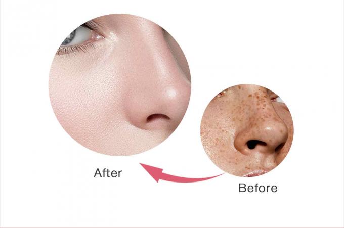 Crema facial Retinol para la eliminación de pecas Perfumado personalizado y marca privada ofrecidos 8