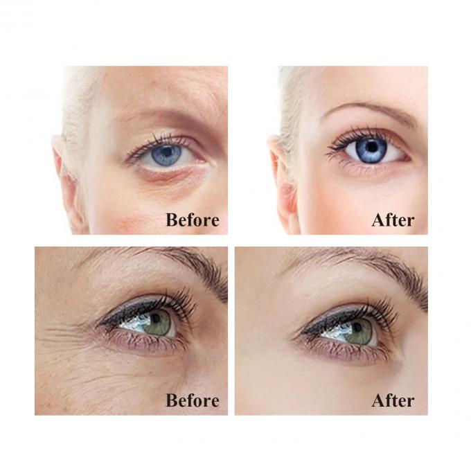 Crema para ojos con firmeza de vitalidad tu arma secreta contra el envejecimiento de los ojos y las ojeras 9
