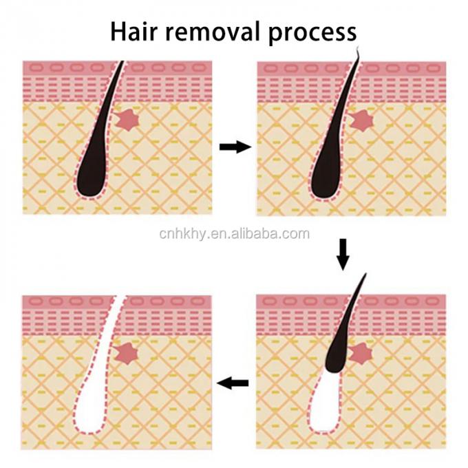 Inhibidor de cabello de hierbas para la piel sensible Ingredientes de hierbas Aloe olor suave fórmula 5