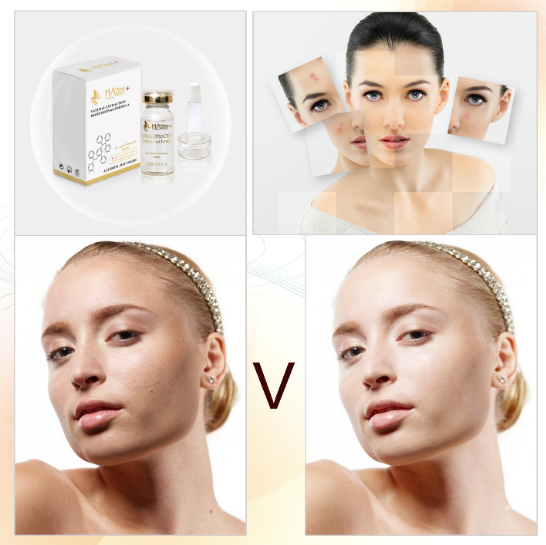 Tamaño regular Vitamina C orgánica Purificante Blanqueador Anti pecas Ampulas Cantidad 1000 1