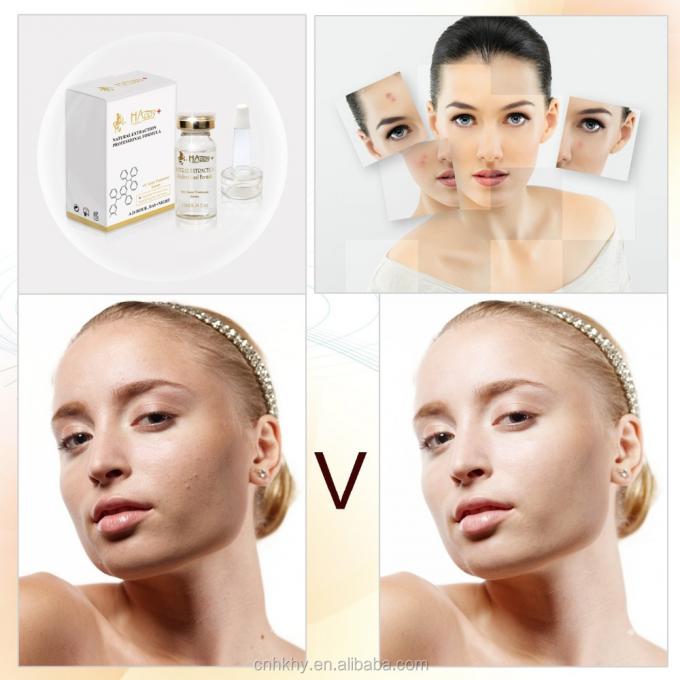 Elimina las cicatrices del acné con QBEKA Happy Cosmetics Levorotatory VC original Liquid Bio Serum 0