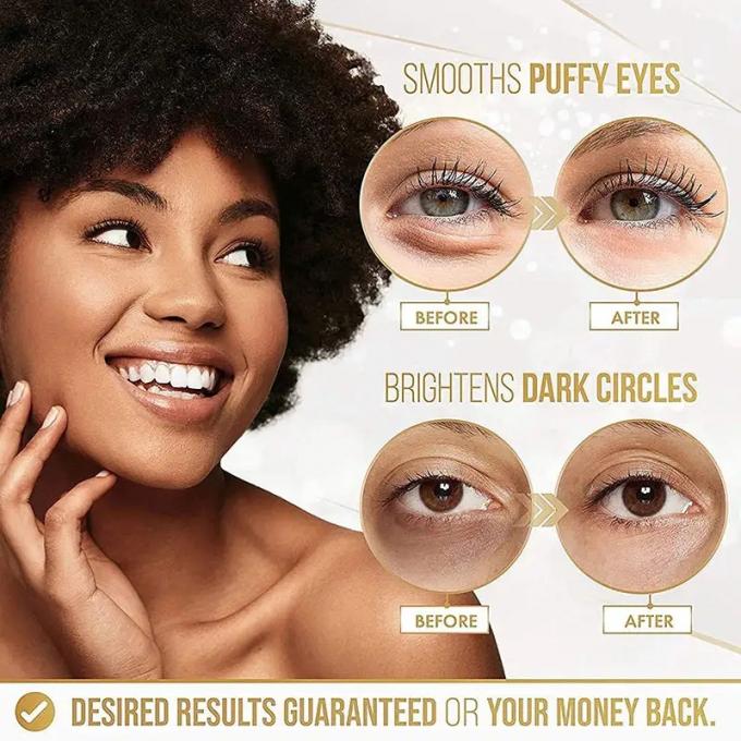Mascarilla de ojos de oro hidratante para reducir líneas finas y arrugas Equipo profesional de control de calidad 4