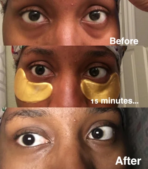 Mascarilla de ojos de oro hidratante para reducir líneas finas y arrugas Equipo profesional de control de calidad 6